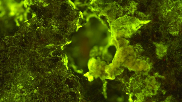 In this microscopic image, Sphingomonas desiccabilis is growing on basalt.