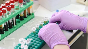 person handling blood samples in a lab