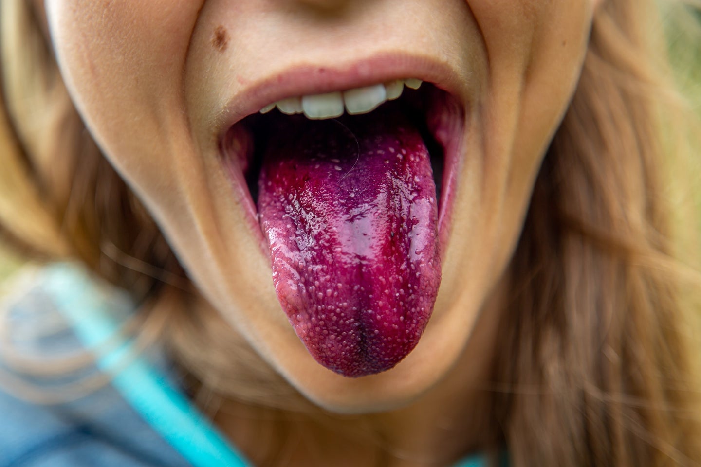 A person sticking out a purple-stained tongue