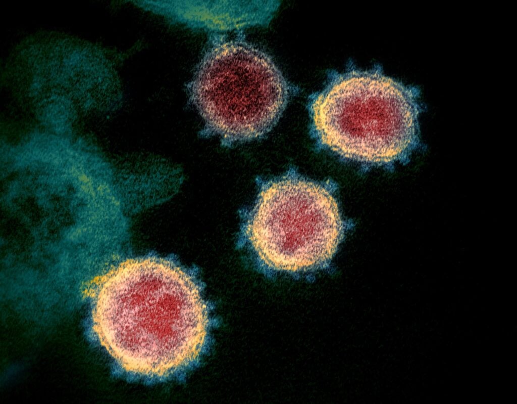 Sars-CoV-2 cells stained in yellow, red, and blue on a black background