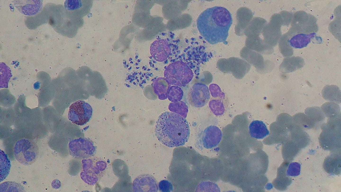 Blue and purple leishmania cells stained under a microscope