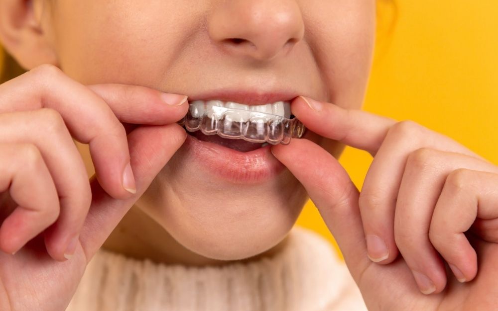 Best teeth-whitening strips of 2023