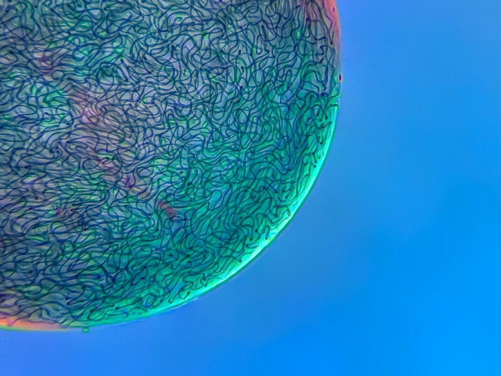 A ball of cyanobacterial strands in a blue gel