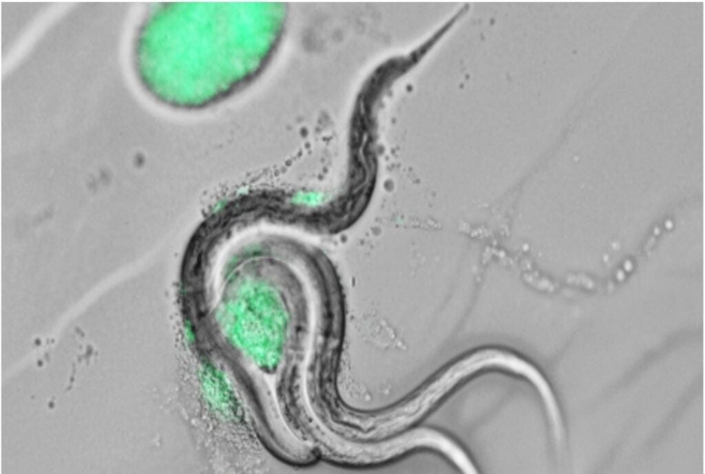 Fluorescent microscopy of nematode worms in black, white, and green