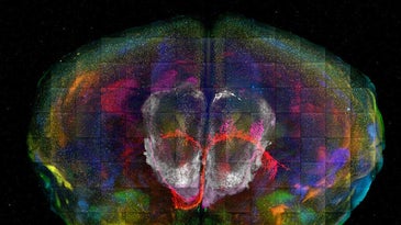 Microscopy image map of human brain and neural cells in different color