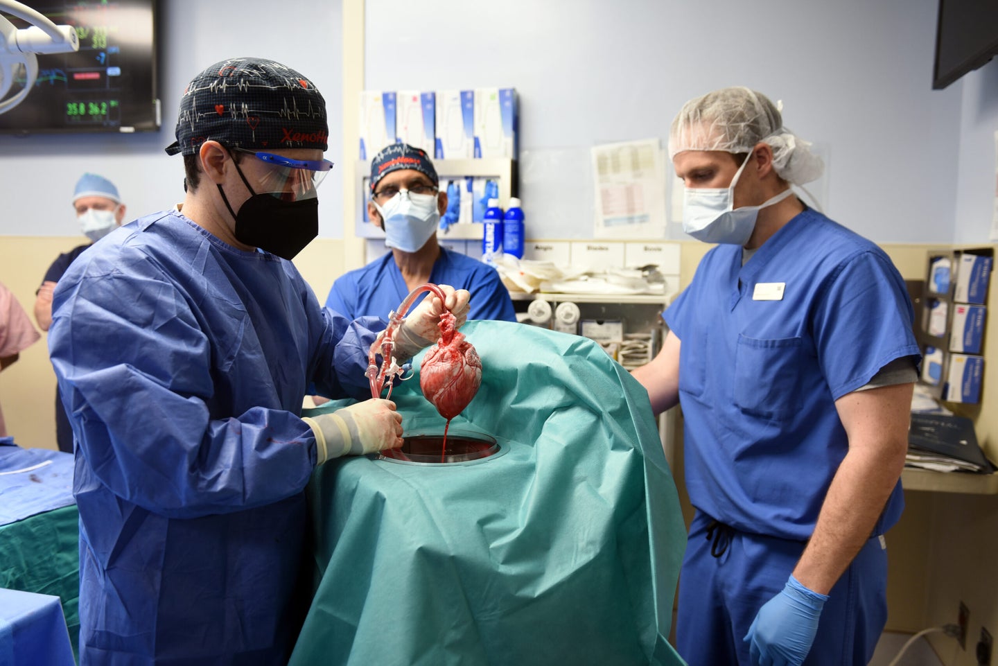 three surgeons in blue scrubs, face masks, gloves, and sanitary gear are in an operating room standing next to a surgical bench covered in blue clothe. the surgeon on the left holds up a heart