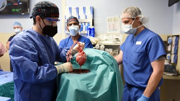 three surgeons in blue scrubs, face masks, gloves, and sanitary gear are in an operating room standing next to a surgical bench covered in blue clothe. the surgeon on the left holds up a heart