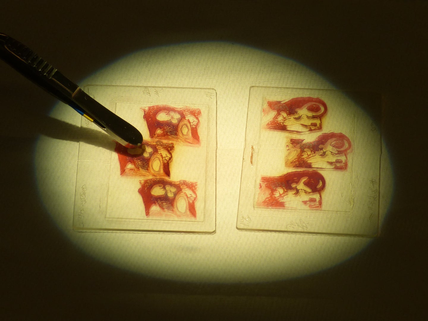 Tweezers on cell slides from the ear of a COVID patients in a patch of light
