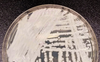 a frontal view of a Petri dish culture plate with streaks of white cellular growth