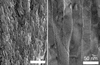 two microscope images side by side of real tooth enamel structure, revealing long rods