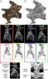CT scans of infected vertebra from Dolly. Photograph and scan model of the infected vertebra (A & B respectively). The colored lines in (B) correspond to the scan slices (and scan interpretative drawings below). White arrows point to the externally visibly abnormal bone growth, while black arrows denote the internal irregularities. (C) Comparison of the abnormal tissue composition of Dolly (left), compared to that of a ‘normal’ sauropod (right).