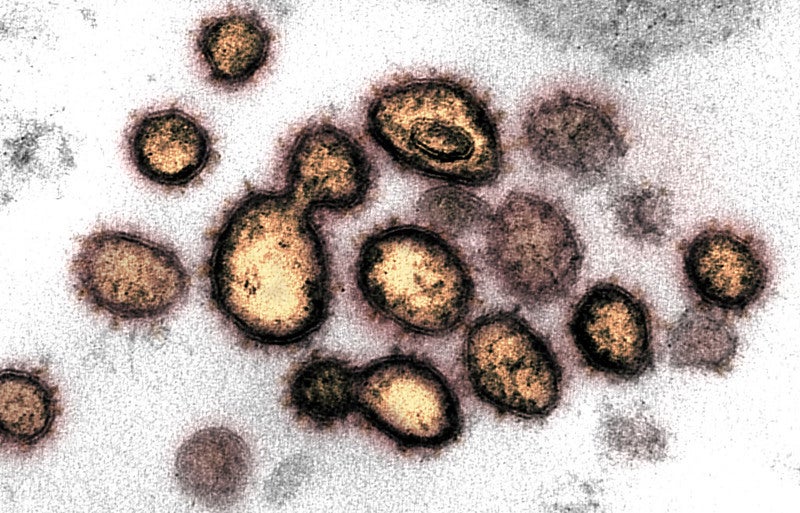 This transmission electron microscope image shows SARS-CoV-2 isolated from a patient in the US. The spikes on the outer edge of the virus particles give coronaviruses their name, crown-like.