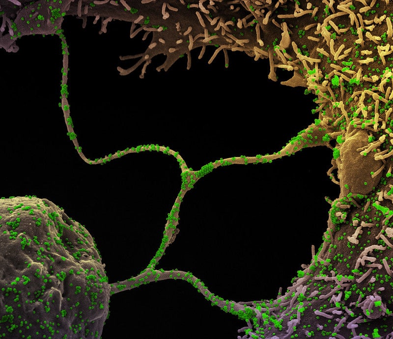 SARS-CoV-2 virus grappling other human cells to infect in a green, yellow, purple microscopy image on black