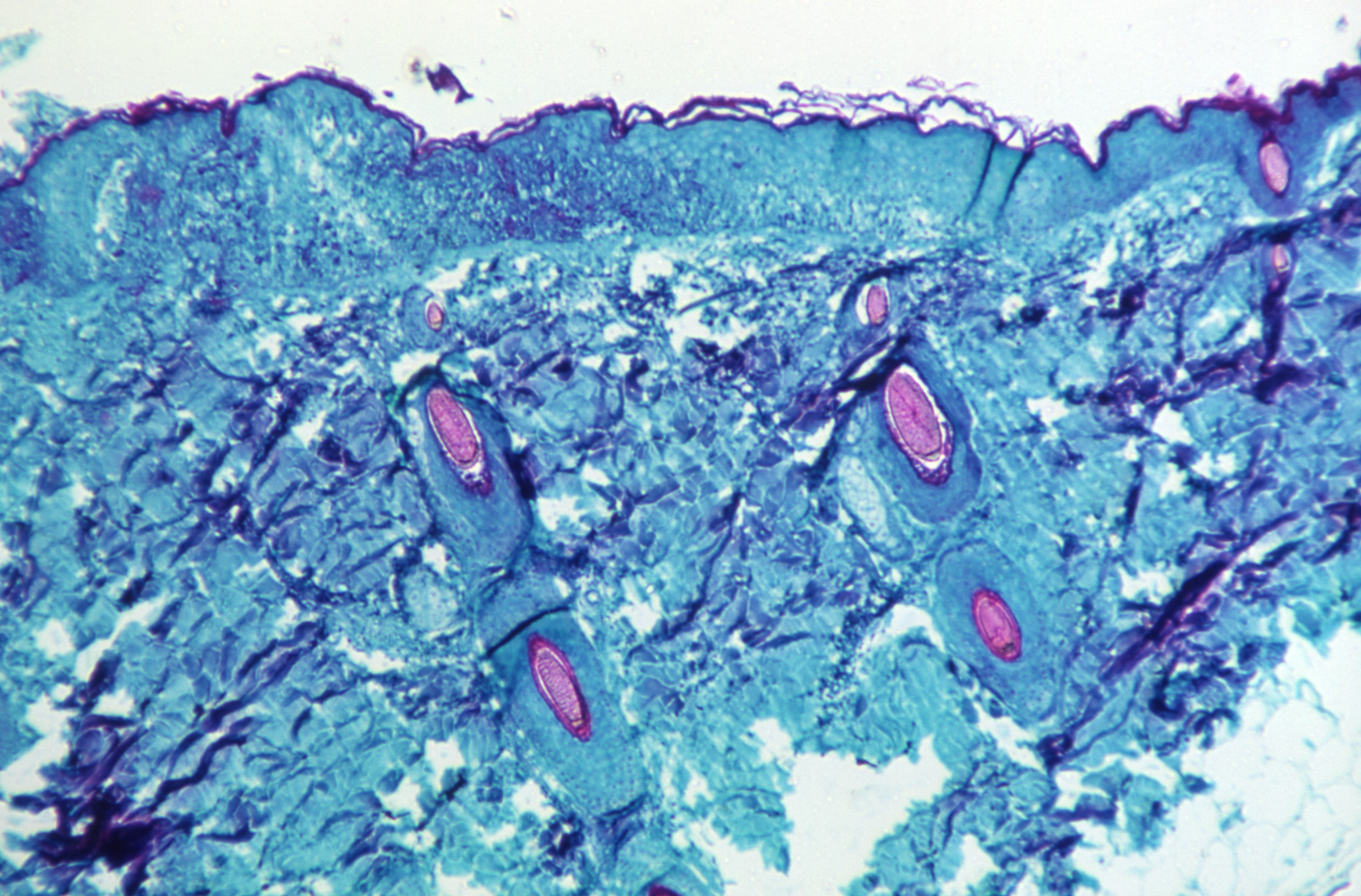 A blue and pink microscope slide showing several ovals in animal flesh.