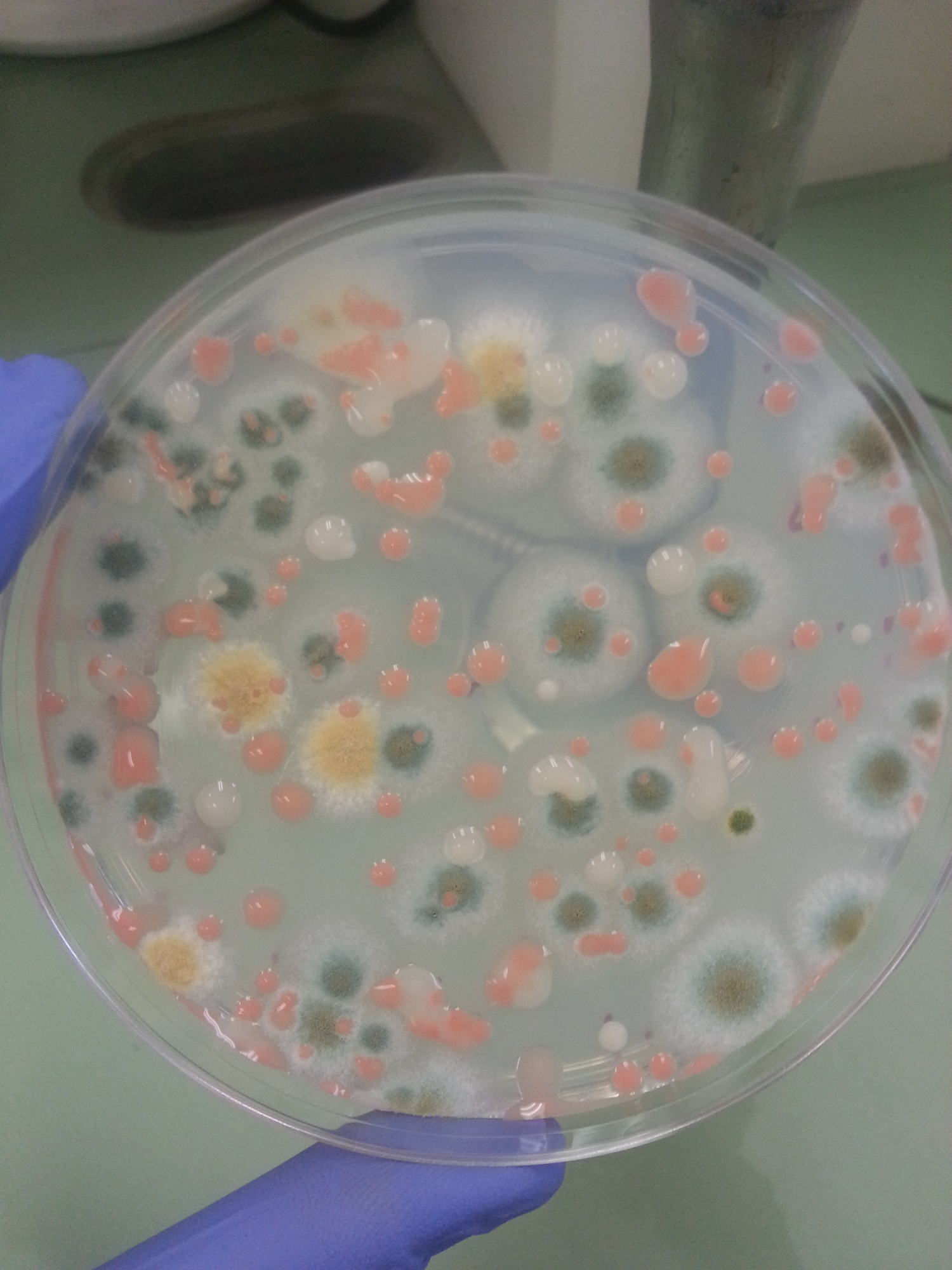 una varietà di crescita microbica di vari colori su una capsula di Petri