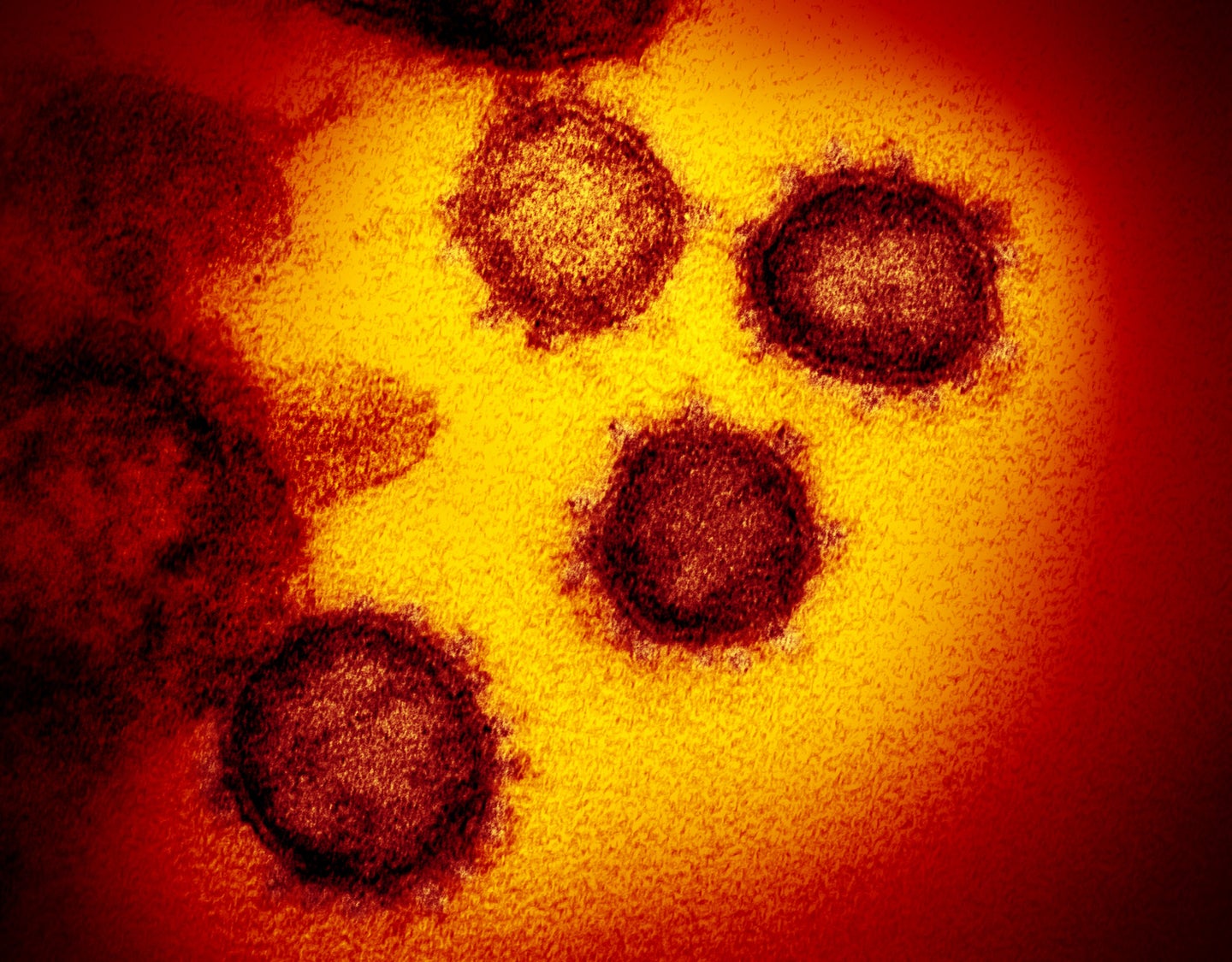 A microscope image of several SARS-CoV-2 virus particles.