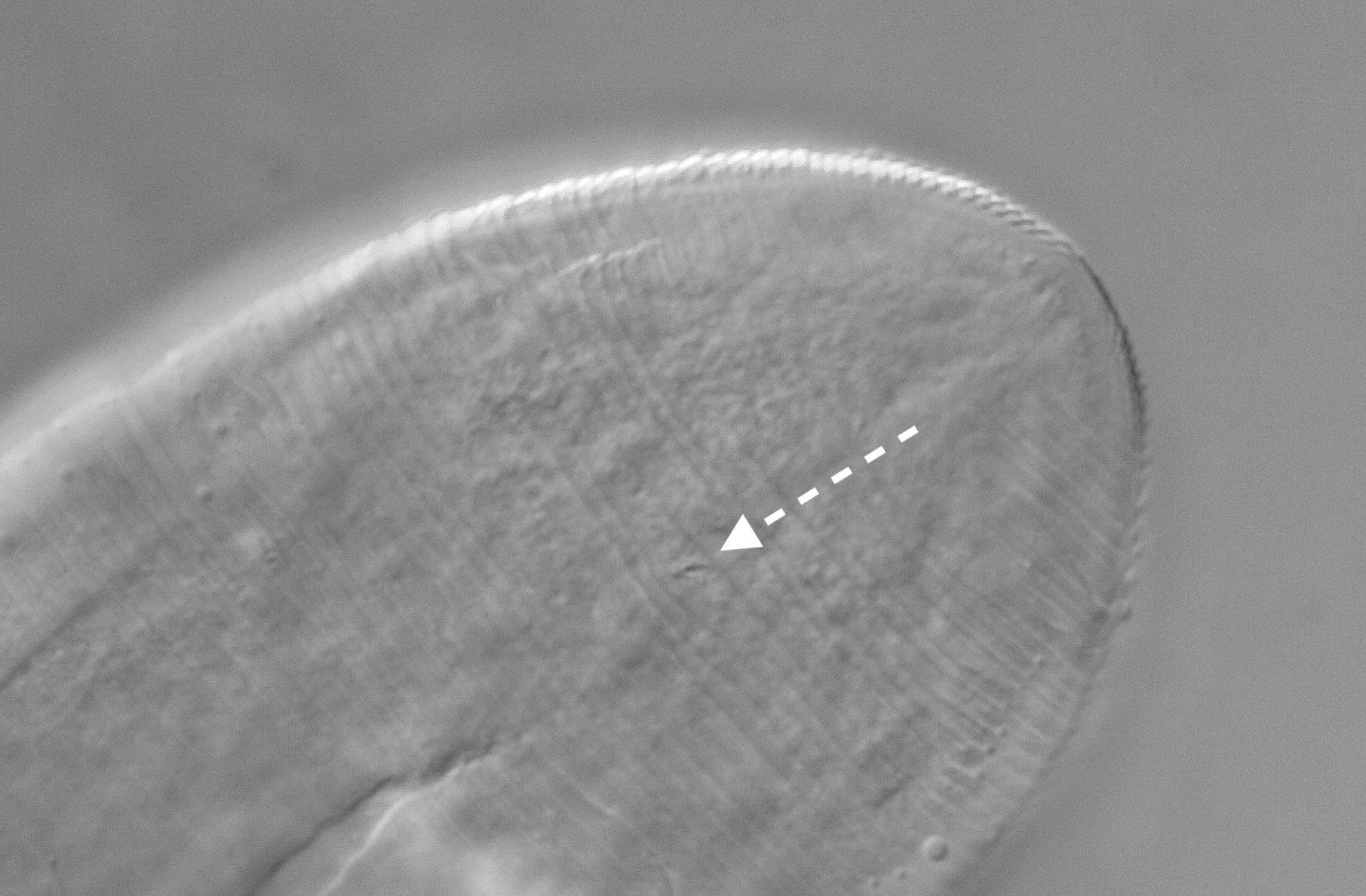 a close up of a face mite anus under a microscope