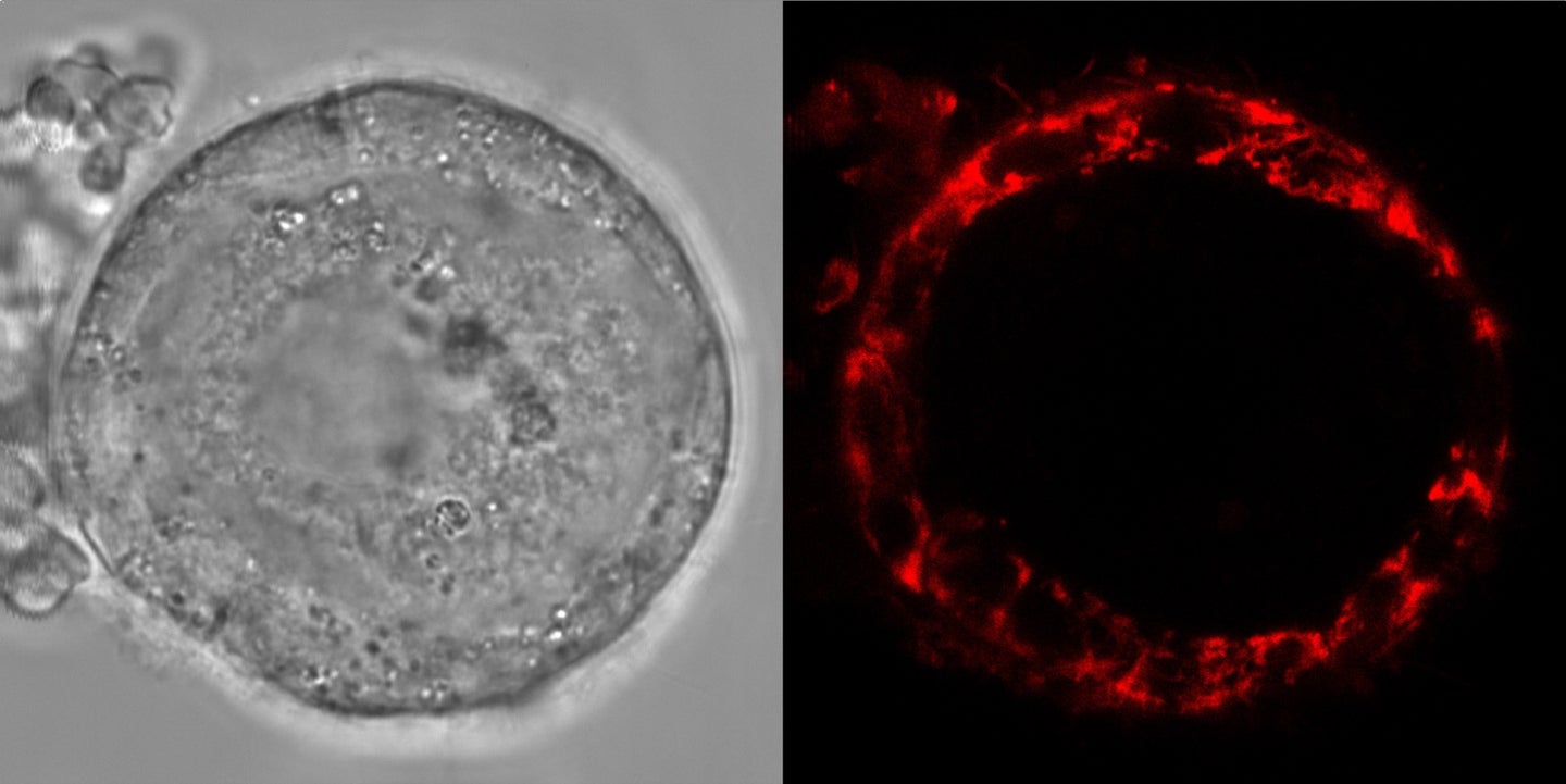 human oocytes seen under a microscope. on the left is a normal image, and on the right is the cell dyed and fluorescing to show the amount of reactive oxygen species