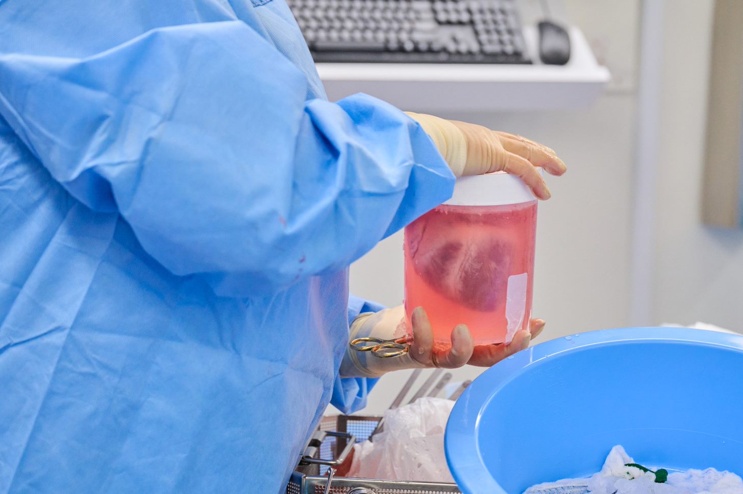 How organ-transplant teams hunt for hidden animal-to-human viruses