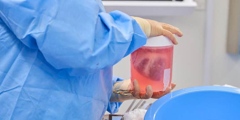 How organ-transplant teams hunt for hidden animal-to-human viruses