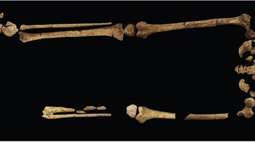 A 31,000-year-old grave in Indonesia holds the earliest known amputation patient
