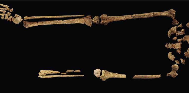 A 31,000-year-old grave in Indonesia holds the earliest known amputation patient