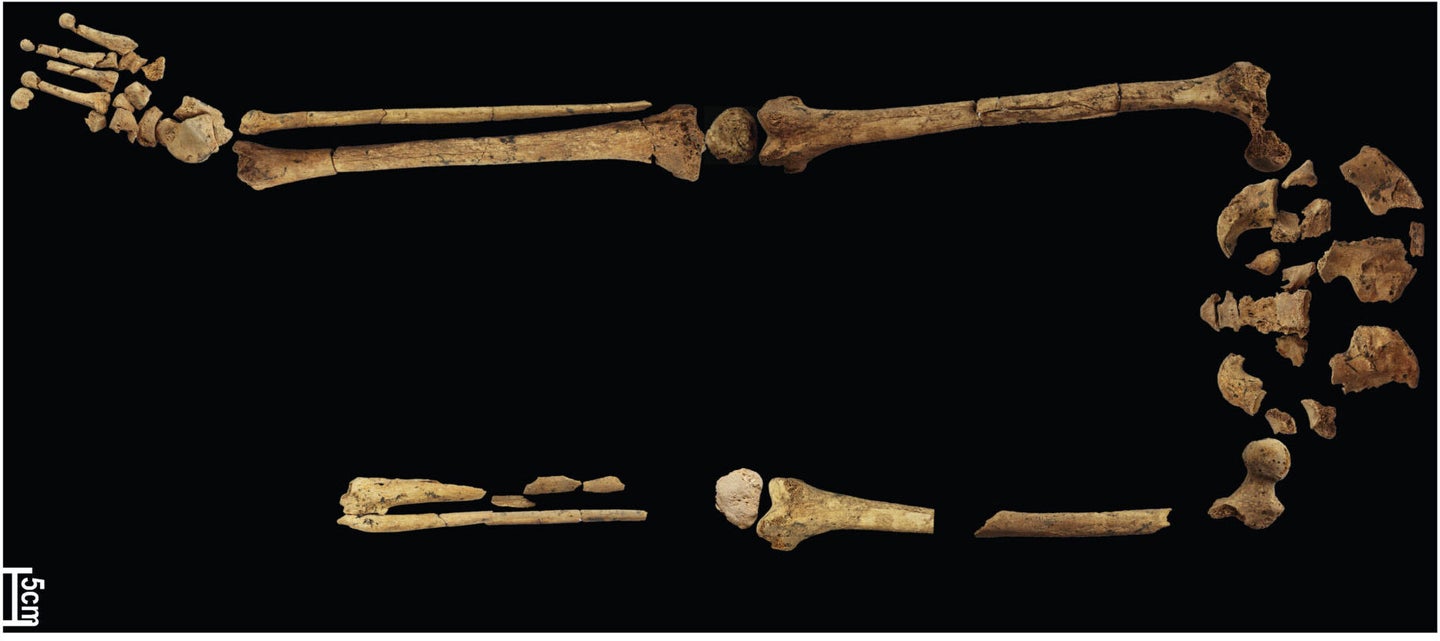 The leg and hip bones of an ancient skeleton, with the left foot missing halfway down the calf.