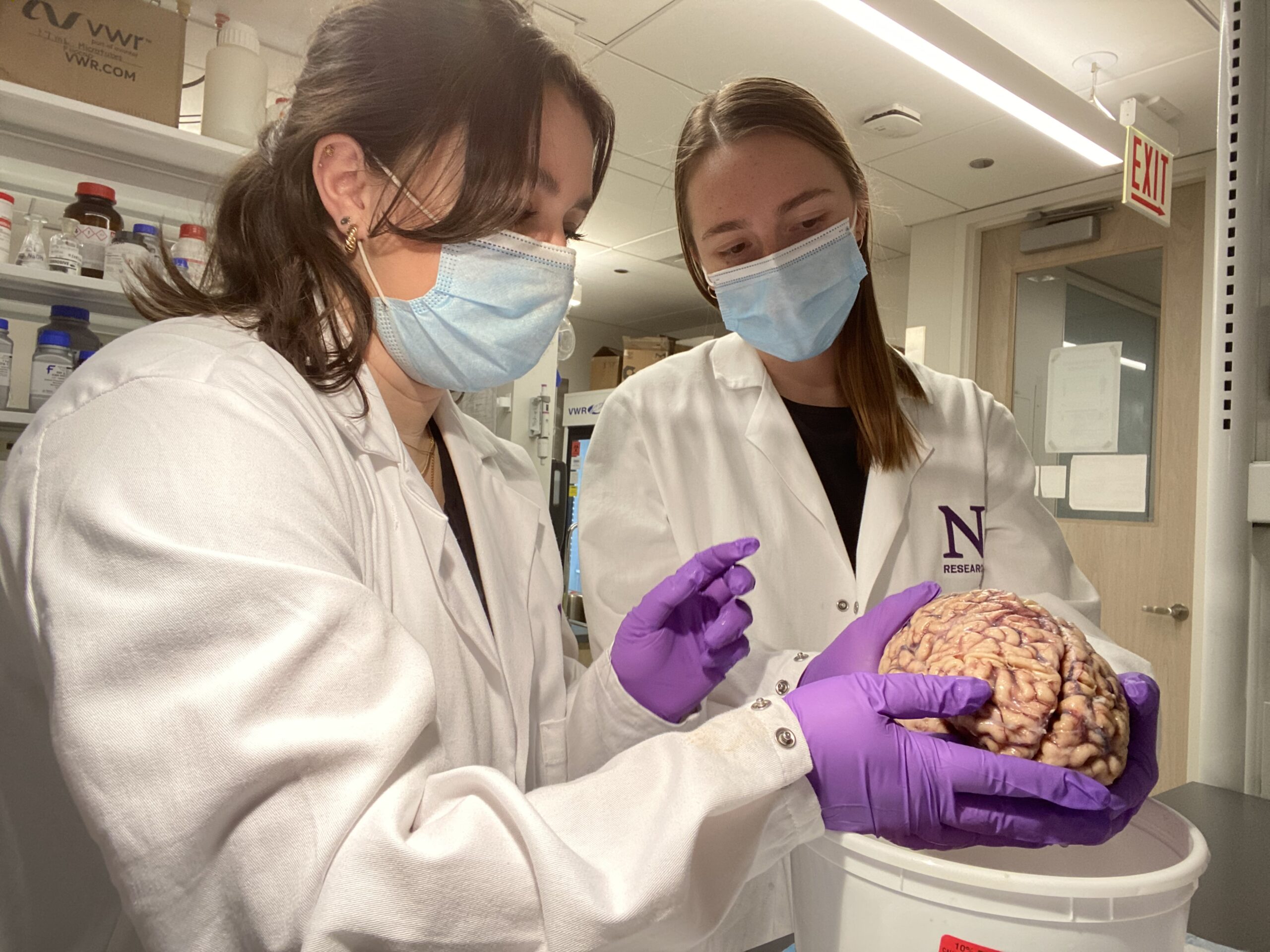 Northwestern University lab members examine a donor human brain to study why some individuals, known as "super-agers," have exceptional memories late in life.