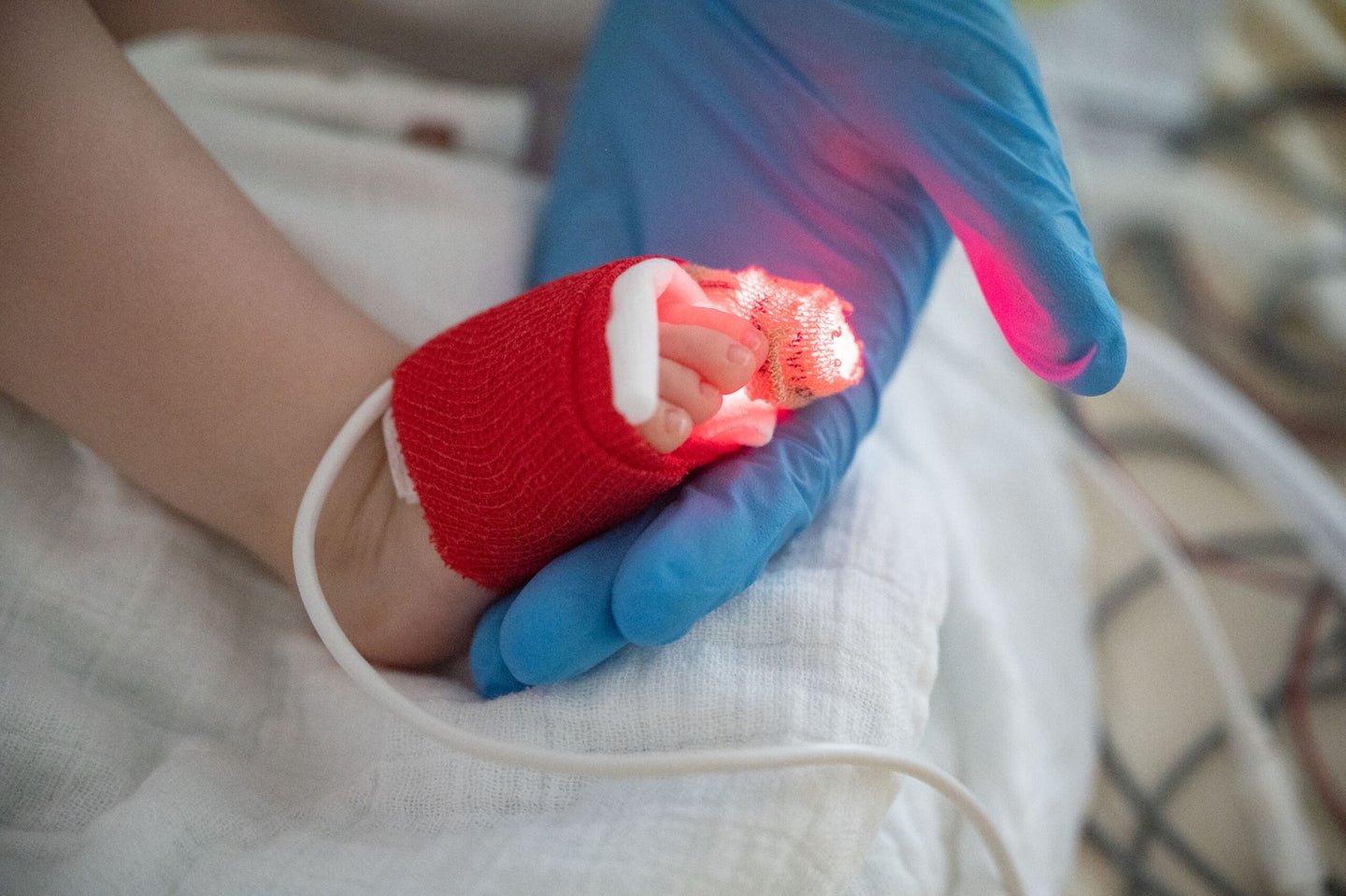 An intensive care nurse holds the foot of a patient suffering from respiratory syncytial virus  (RSV) in Germany.