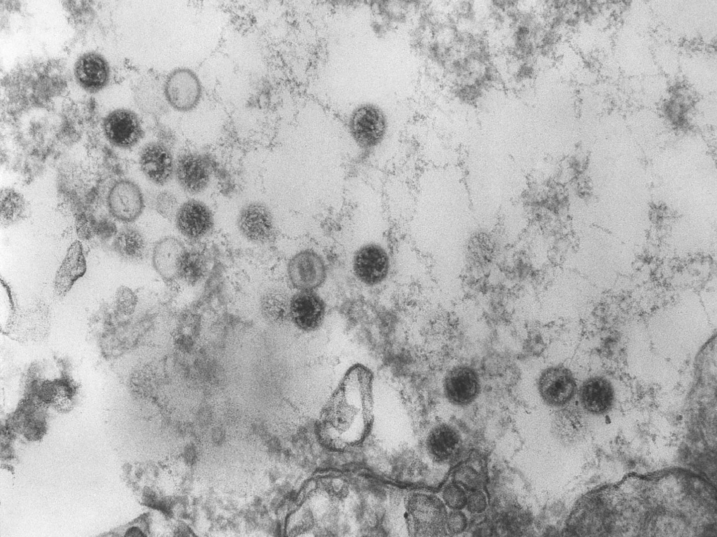 An 1975 electron microscope image reveals several spherical Epstein-Barr virus particles.