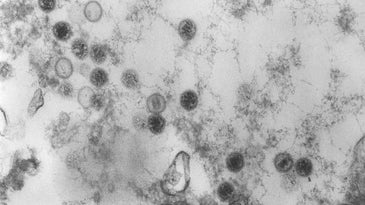 Scientists debate the role of a virus in multiple sclerosis