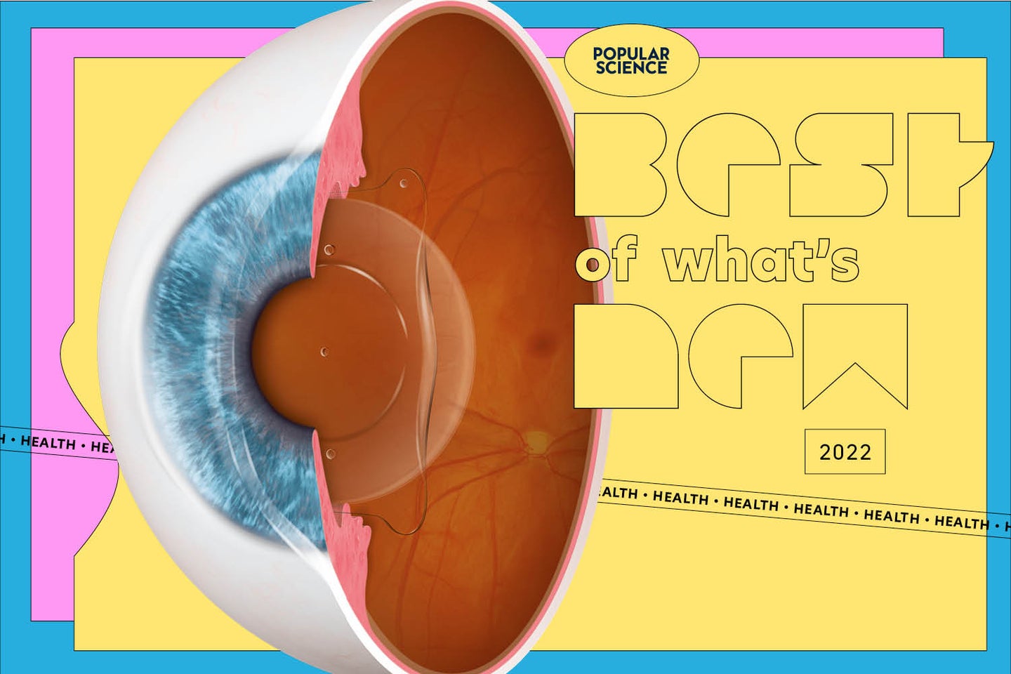 EVO ICL lens implanted in the diagram of an eye with yellow, pink, and blue Best of What's New 2022 Health design on right