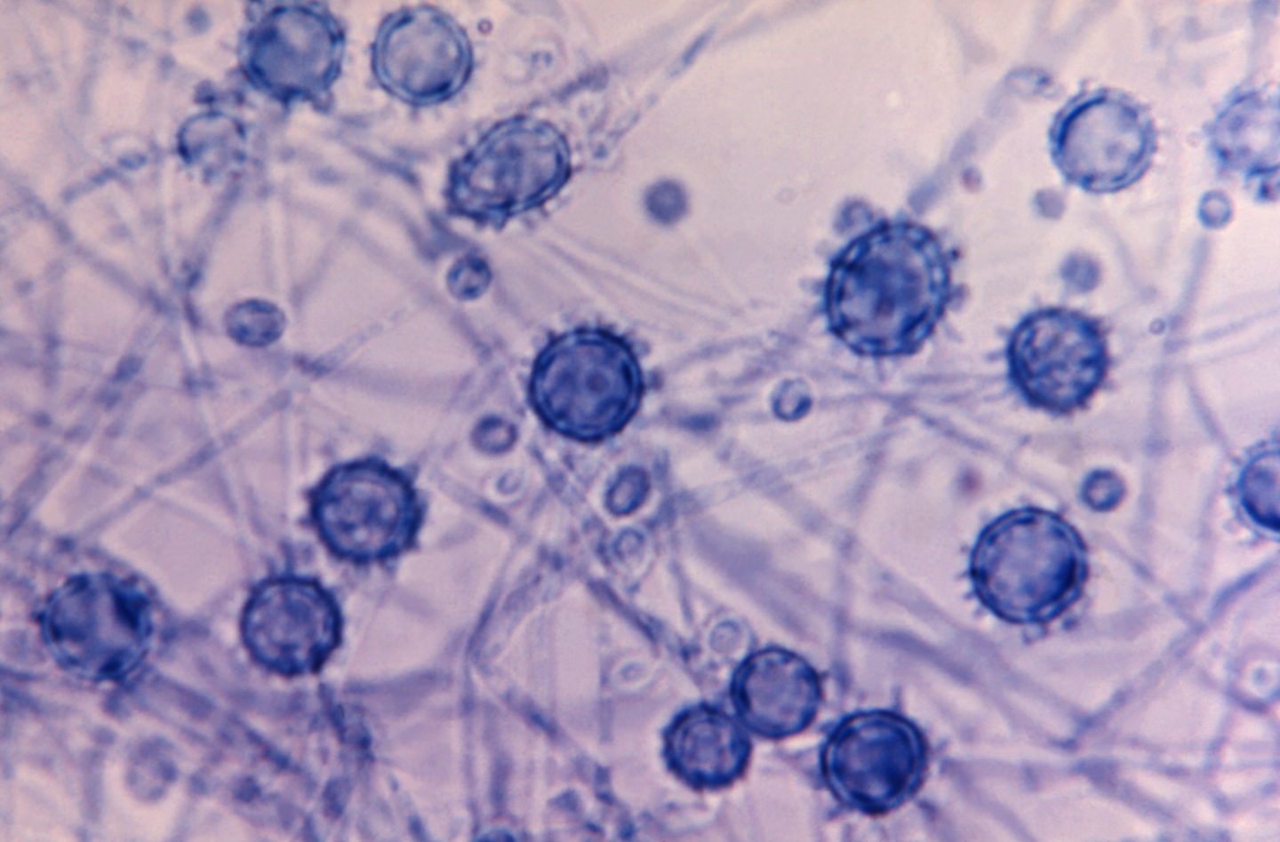 a microscope image of blue stained fungi that have spherical shapes