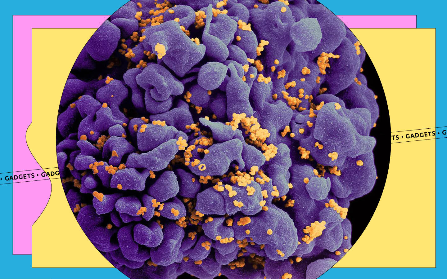 HIV-resistant blood stem cells under a microscope stained in purple and orange