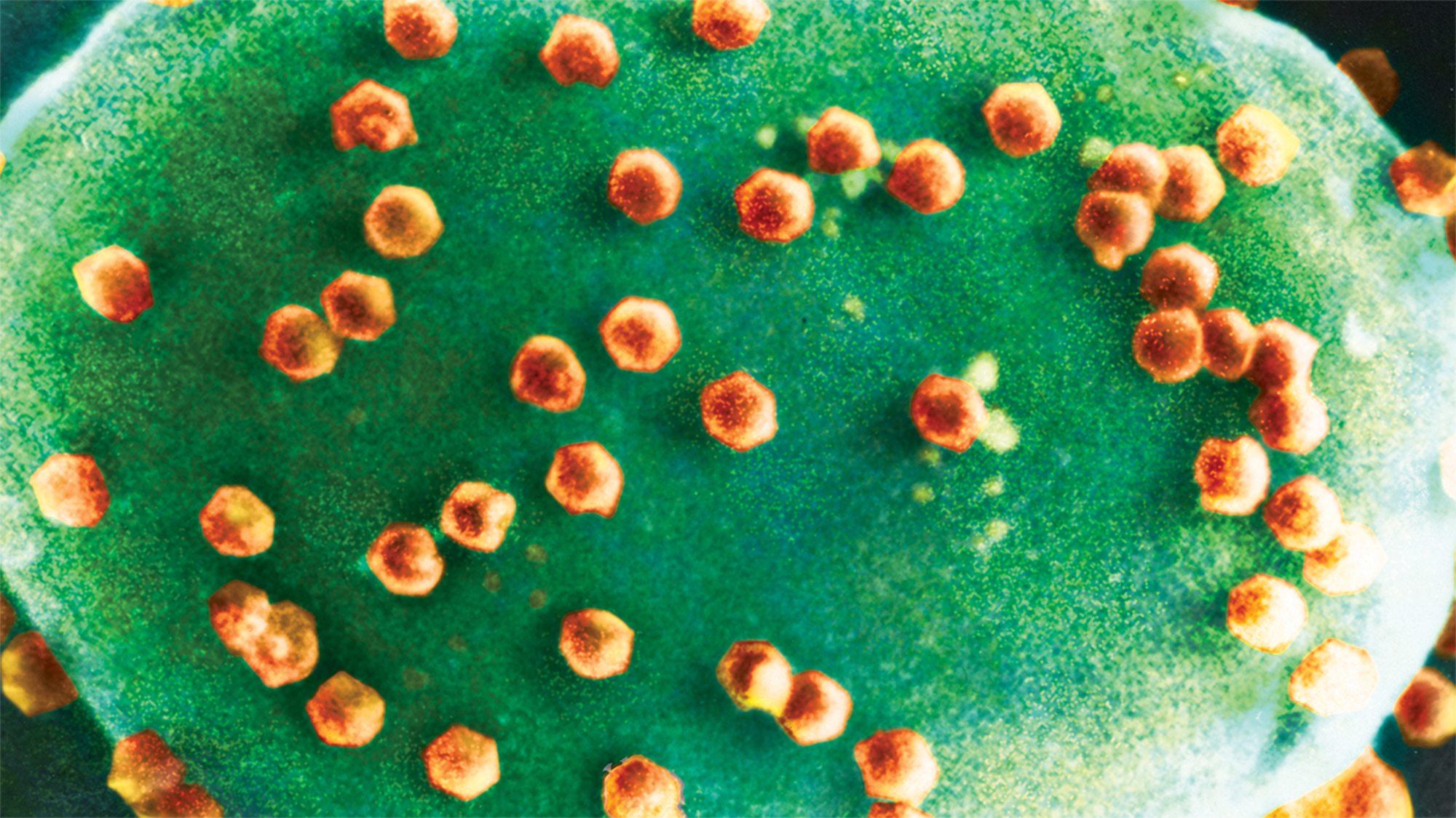 These microbes could be the first lifeforms to munch on infectious viruses