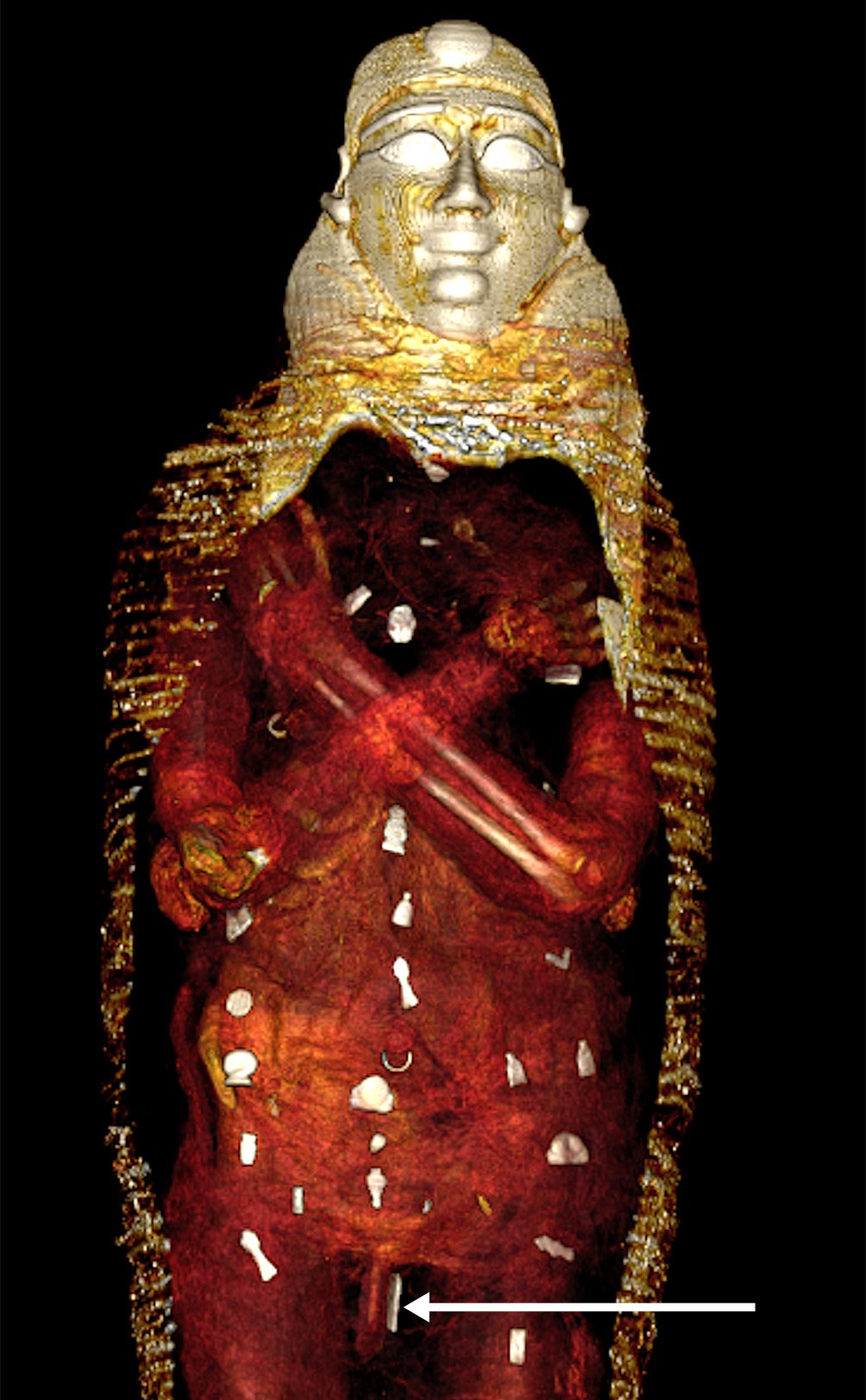 This teen mummy was buried with dozens of gold amulets