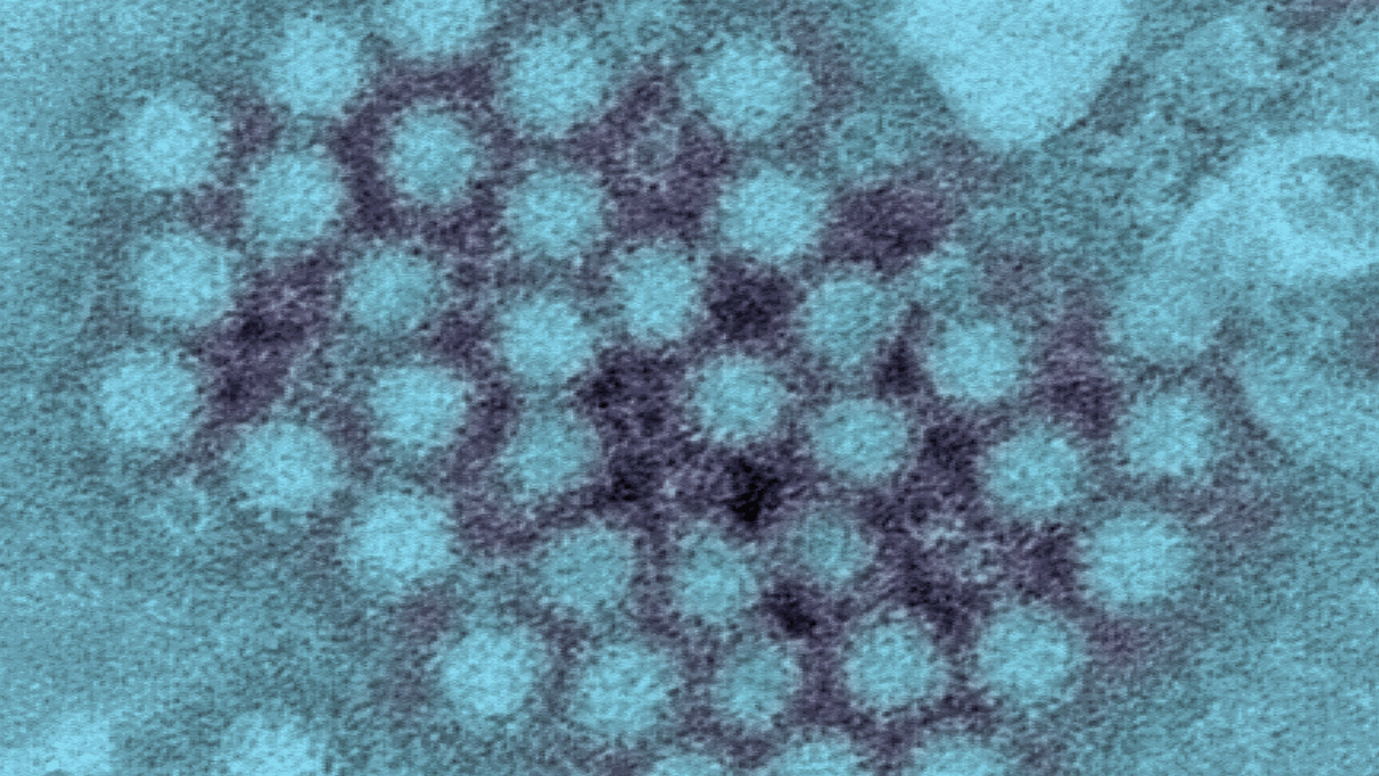 Norovirus is spiking across the United States