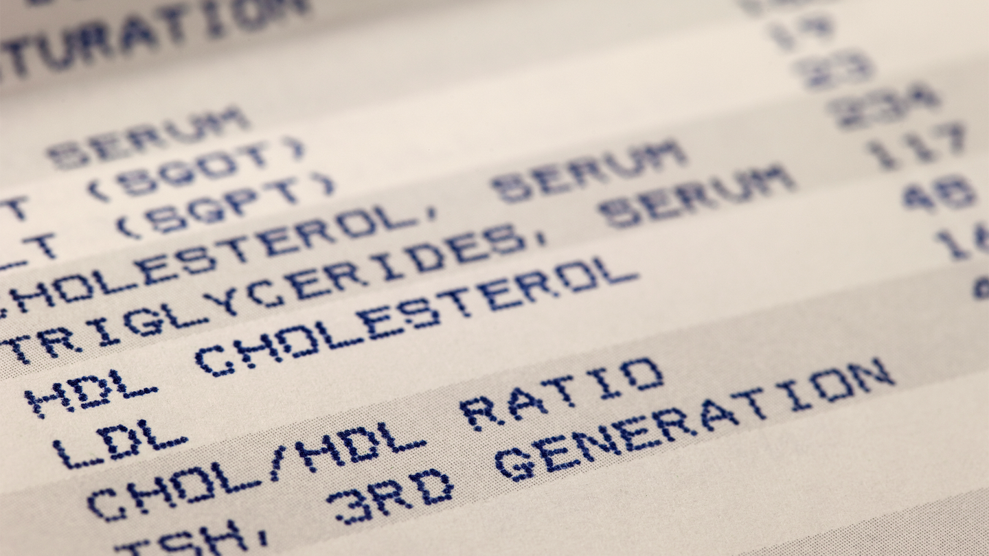 A printout cholesterol screening results.