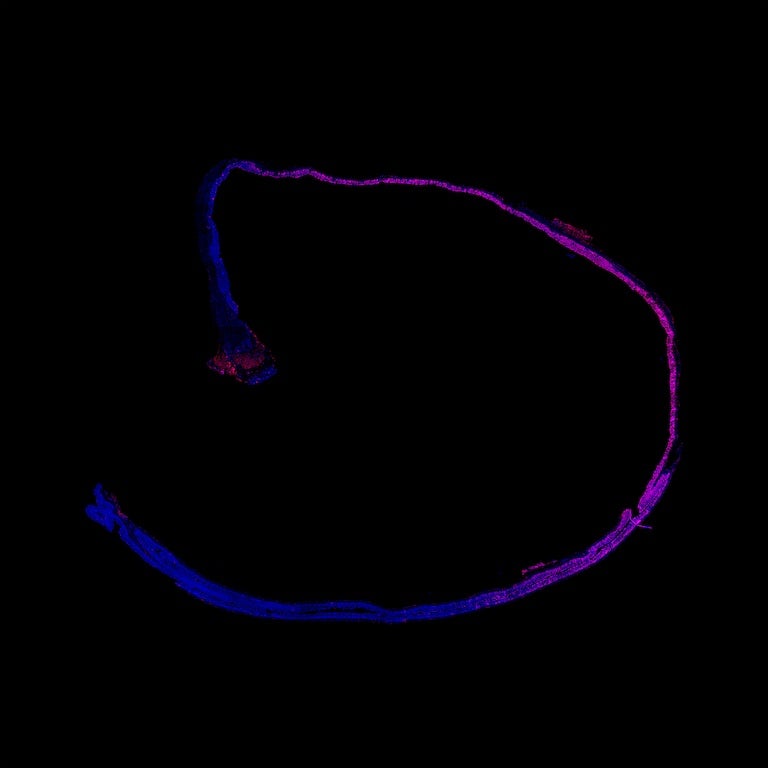 A mouse colon targeted by a radiation beam.