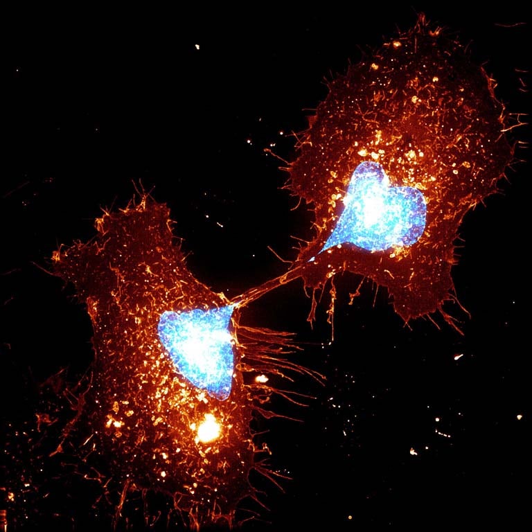 Two cells frozen as they divide.