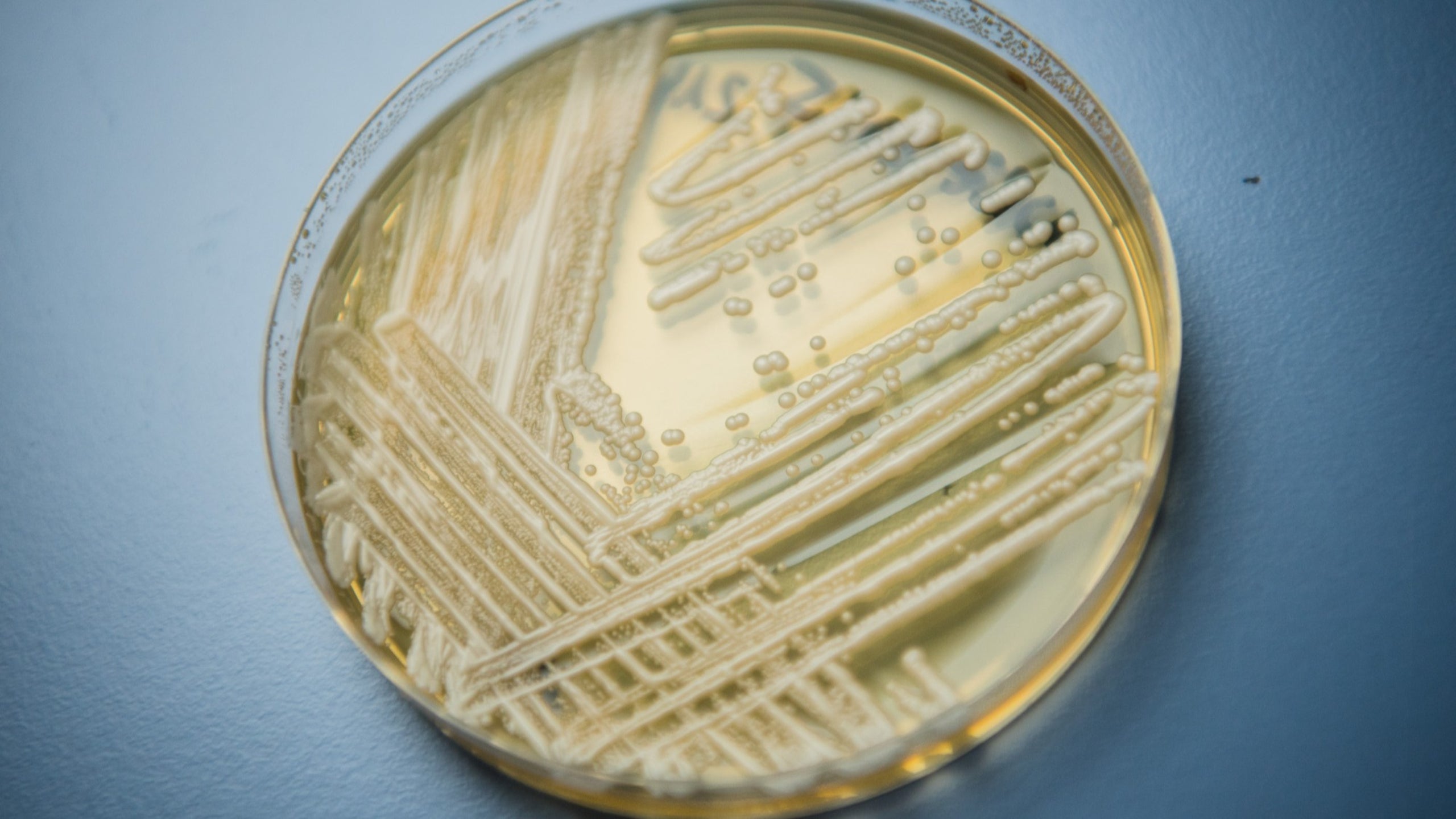 A drug-resistant fungus is spreading in US hospitals—here’s what you need to know