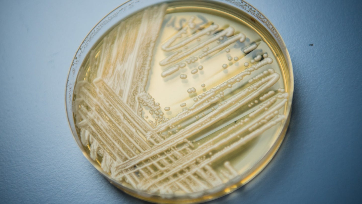Candida auris in a petri dish taken in a laboratory of Wuerzburg University in Wuerzburg, Germany, January 23, 2018.