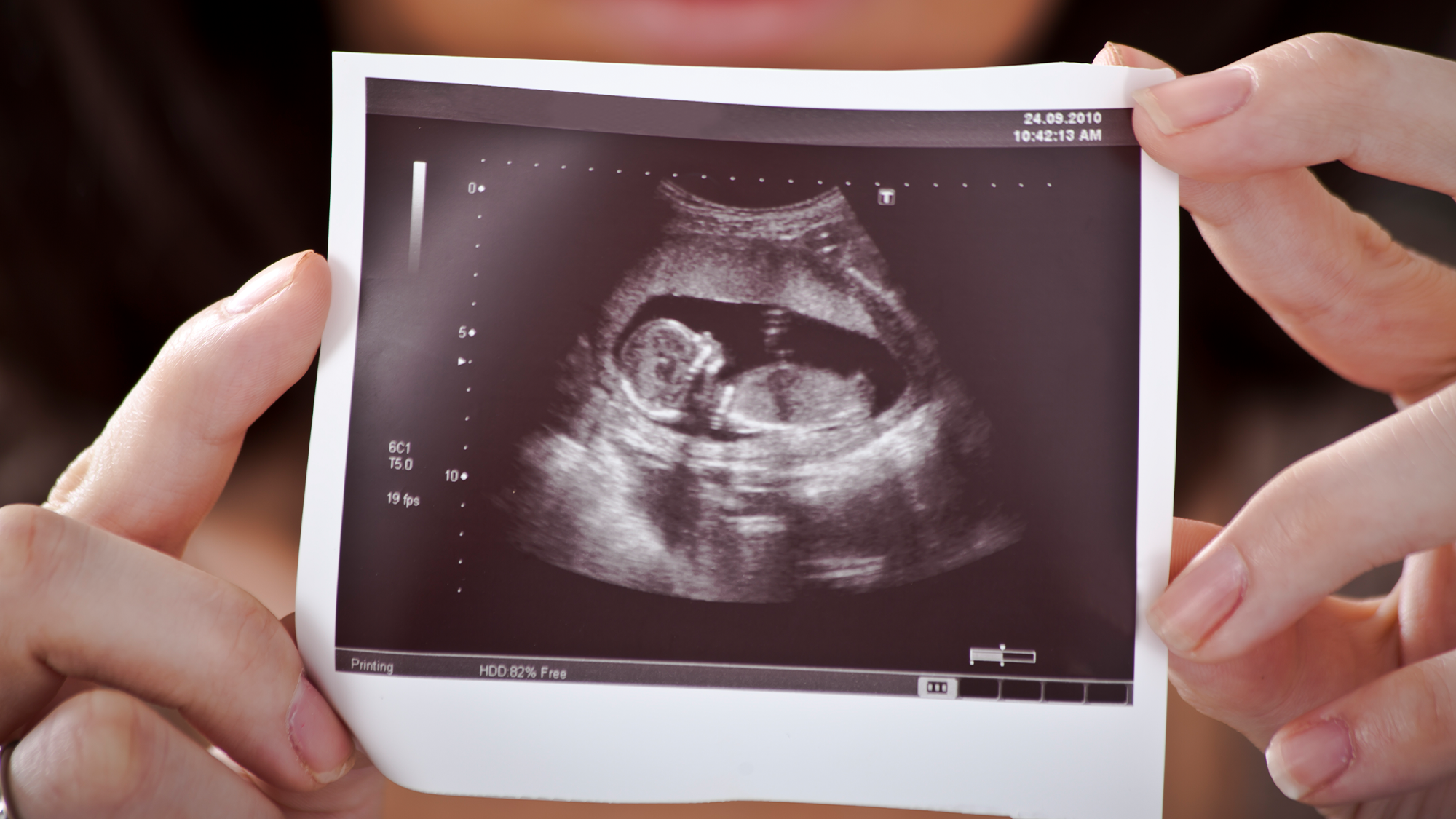 A woman holds an ultrasound photo of a baby.