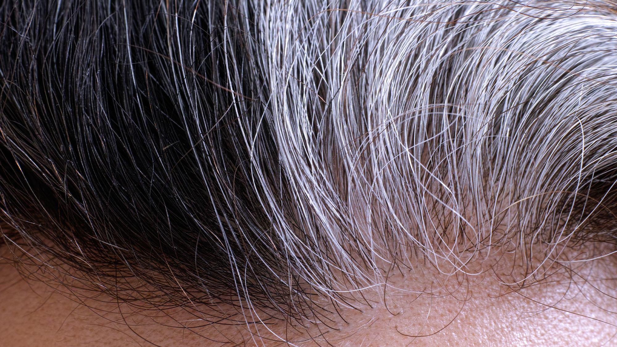 Gray hair growing on a male's head.