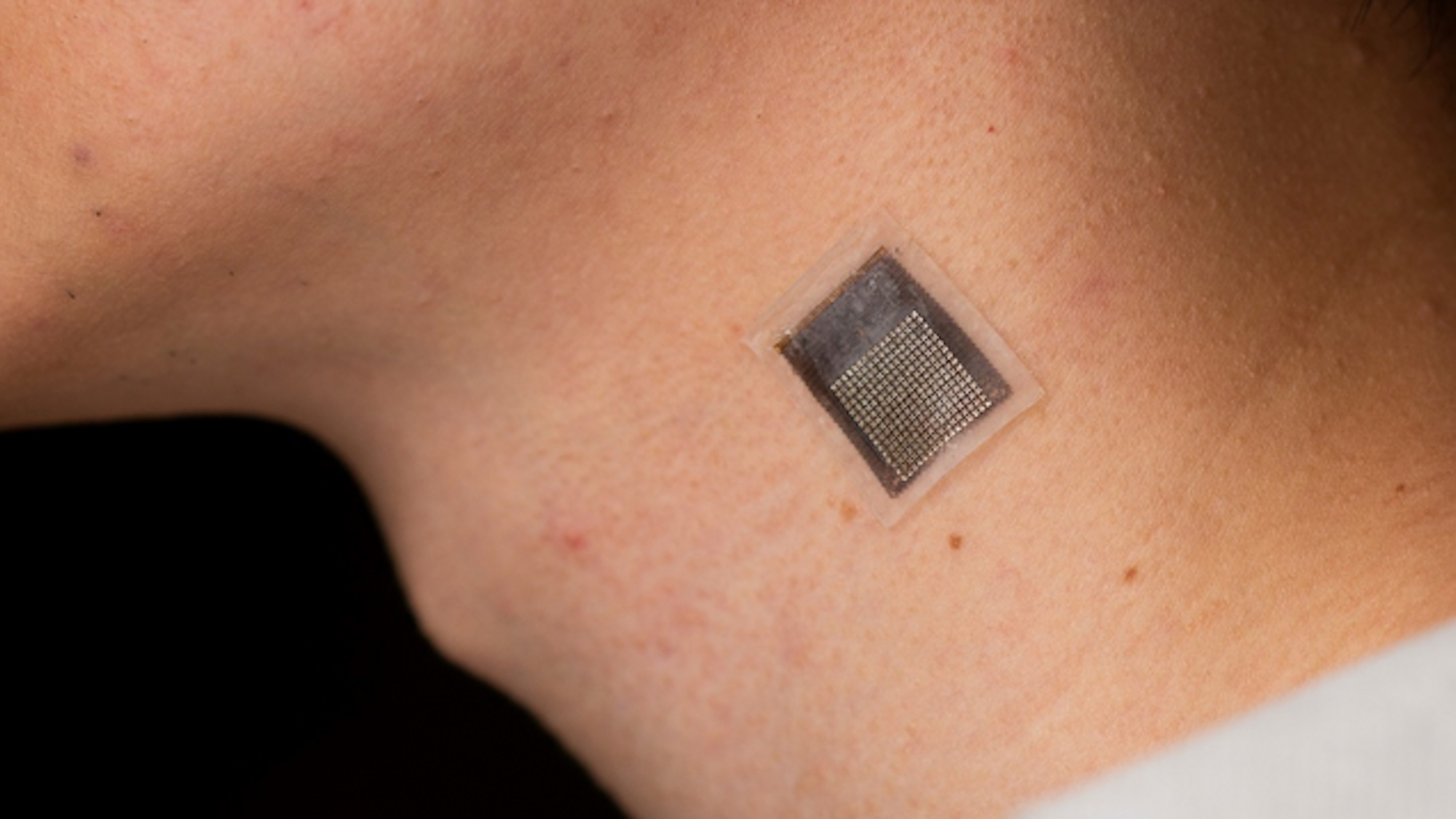 Close-up of patient's neck with a wearable ultrasound patch