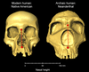 Modern human and archaic Neanderthal skulls side by side, showing difference in nasal height