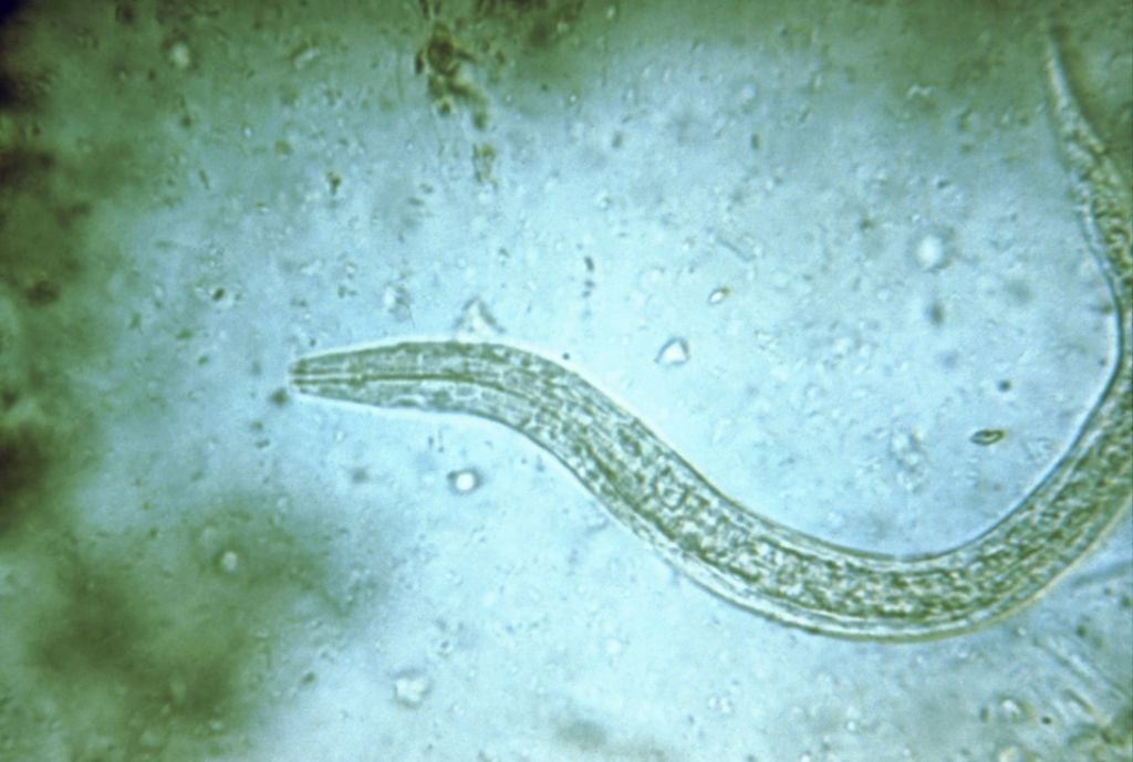 Photomicrograph of human hookworm (Ancylostoma duodenale and Necator americanus) rhabditiform larva which is its early noninfectious stage, 1979. Image courtesy CDC. (Photo by Smith Collection/Gado/Getty Images)