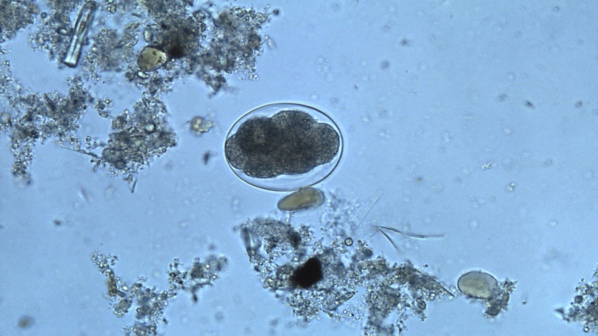 microscopic image of a hookworm egg