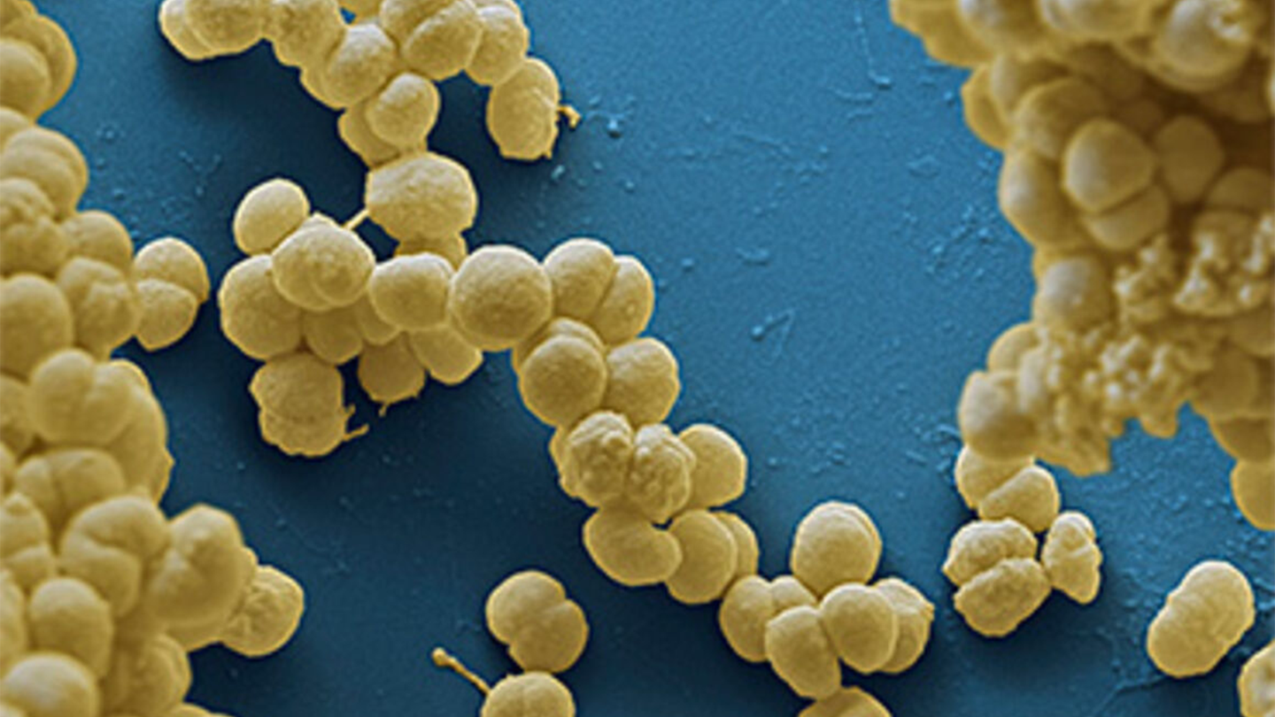 Meningococcal bacteria under a microscope. According to the World Health Organization, meningitis caused an estimated 25,000 deaths in 2019.