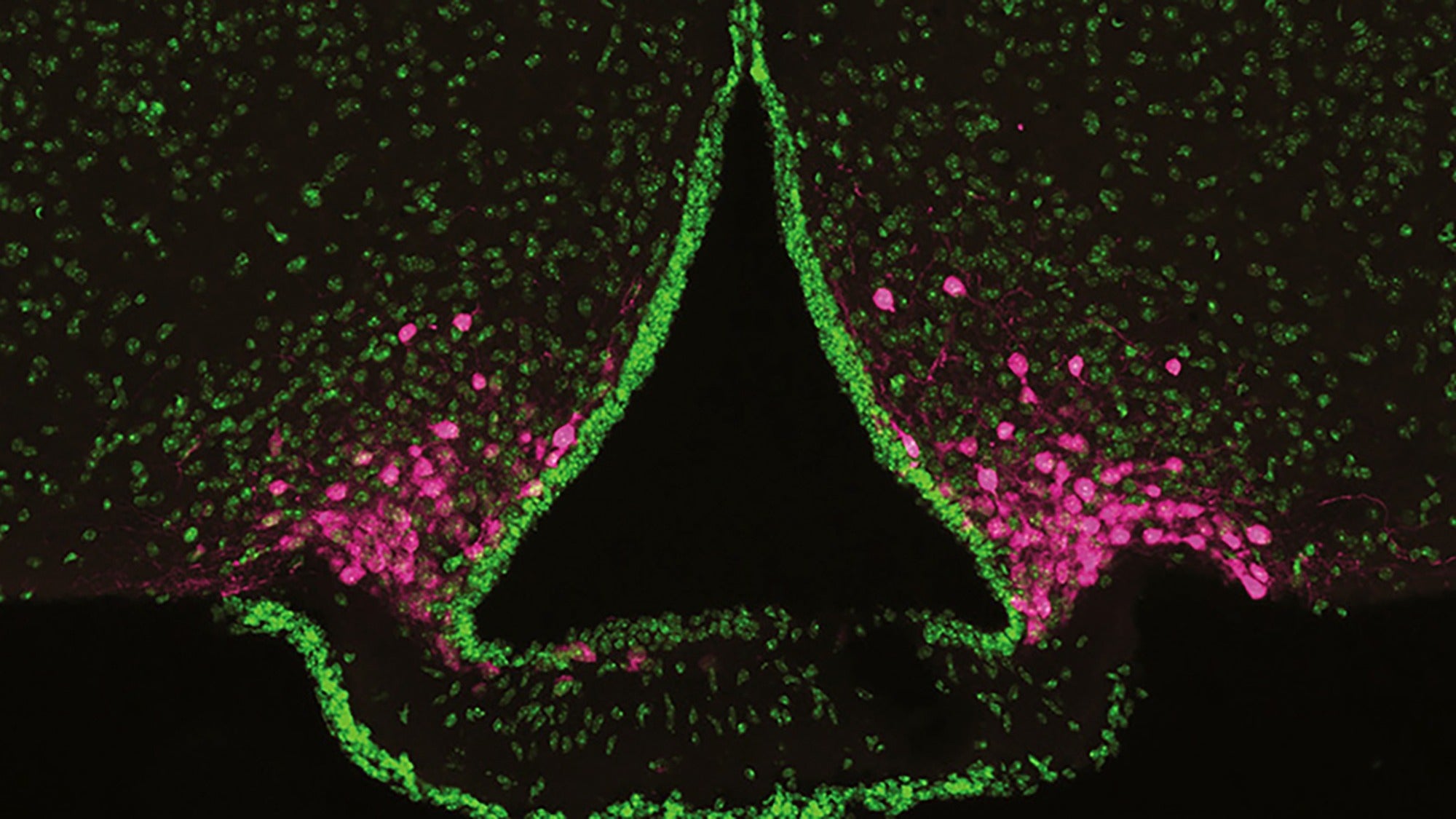 Les neurones qui nous donnent faim